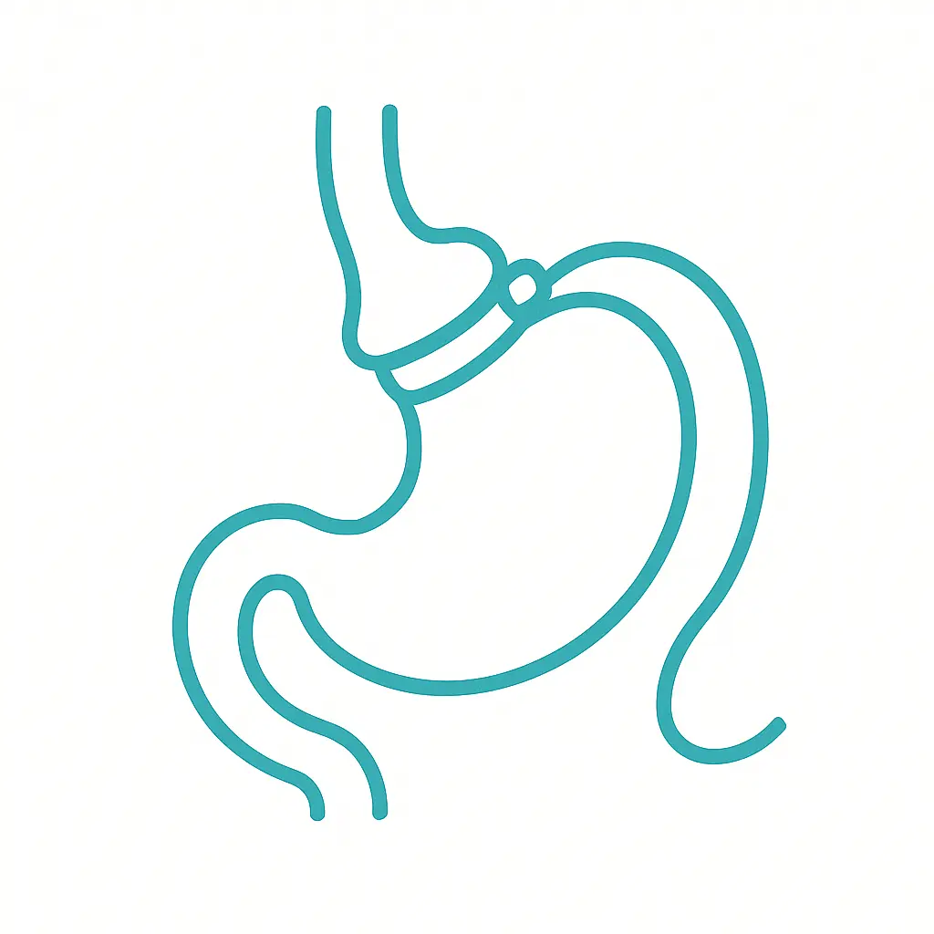 Balón gástrico — alternativa temporal