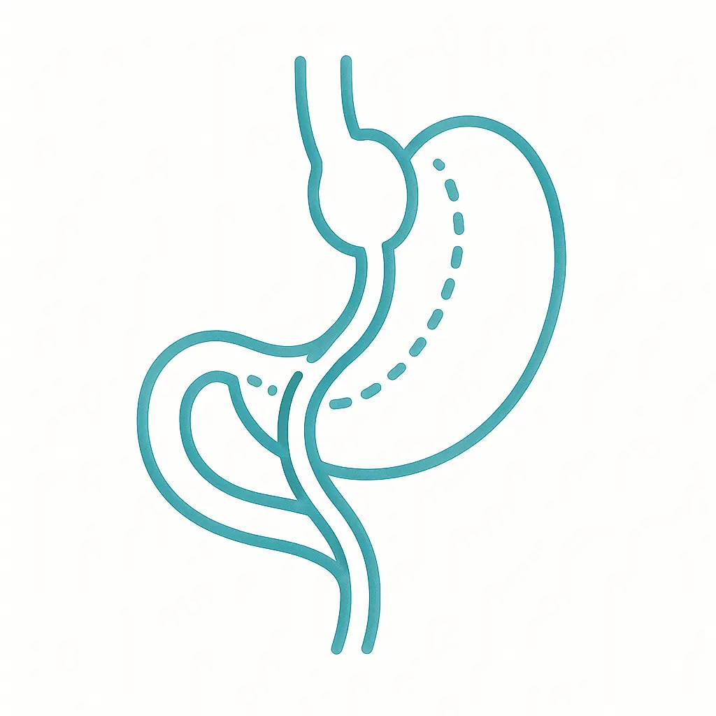 Bypass gástrico — resultados y recuperación