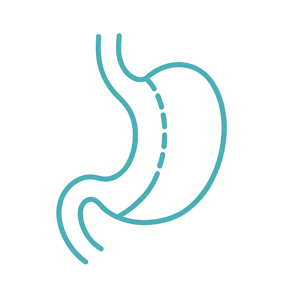 Manga gástrica — técnica y recuperación